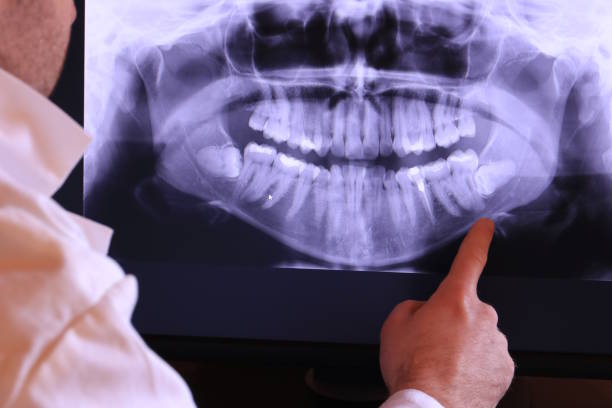 Best Chipped Tooth Repair Near Me  in Gordon, PA